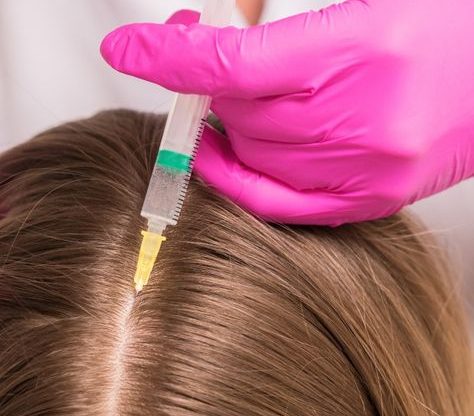 PRP Treatment